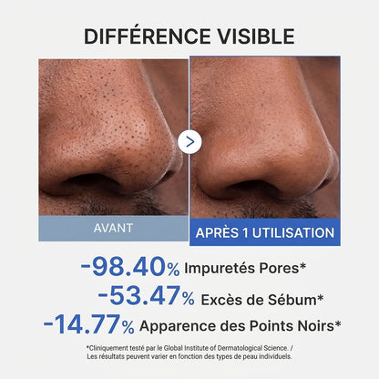 Medicube Zero Pore — Masque Argile Purifiant Anti-Points Noirs & Effet Frais